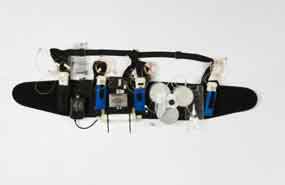 Wearable Artificial Kidney